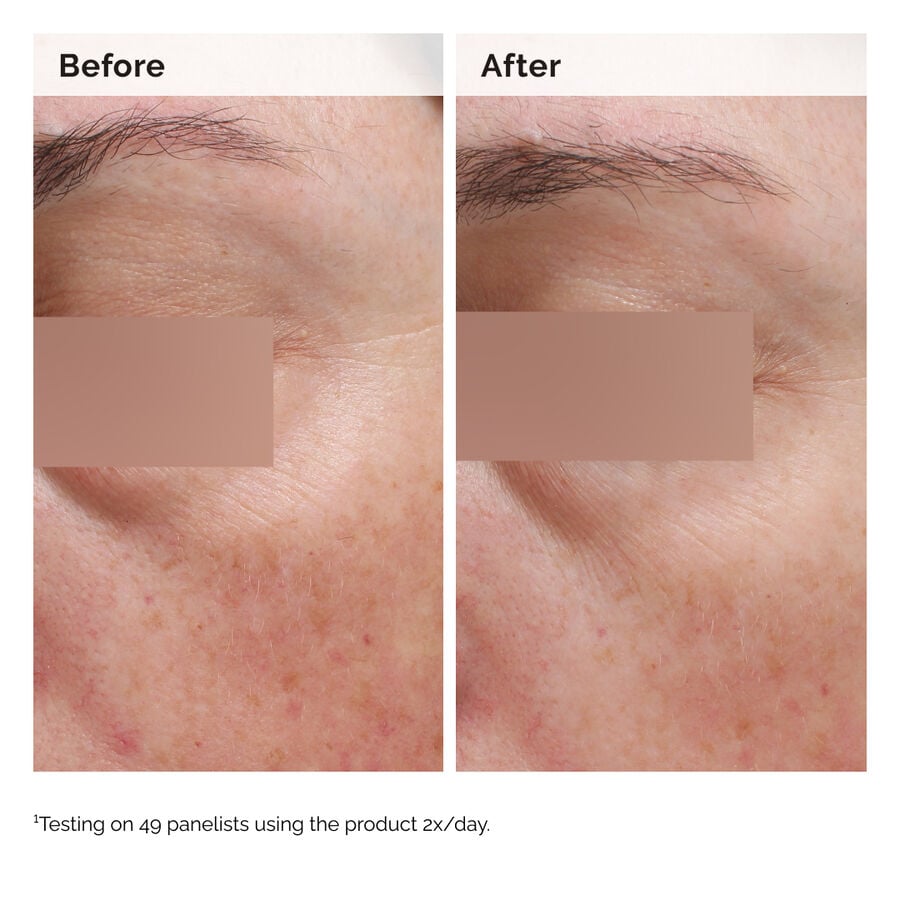 niacinamide-5-face-and-body-emulsion-b4 2024-08-23-ORD-Nia-5pct-Face-Body-B-A-Elasticity-Global-02-1x1.jpg