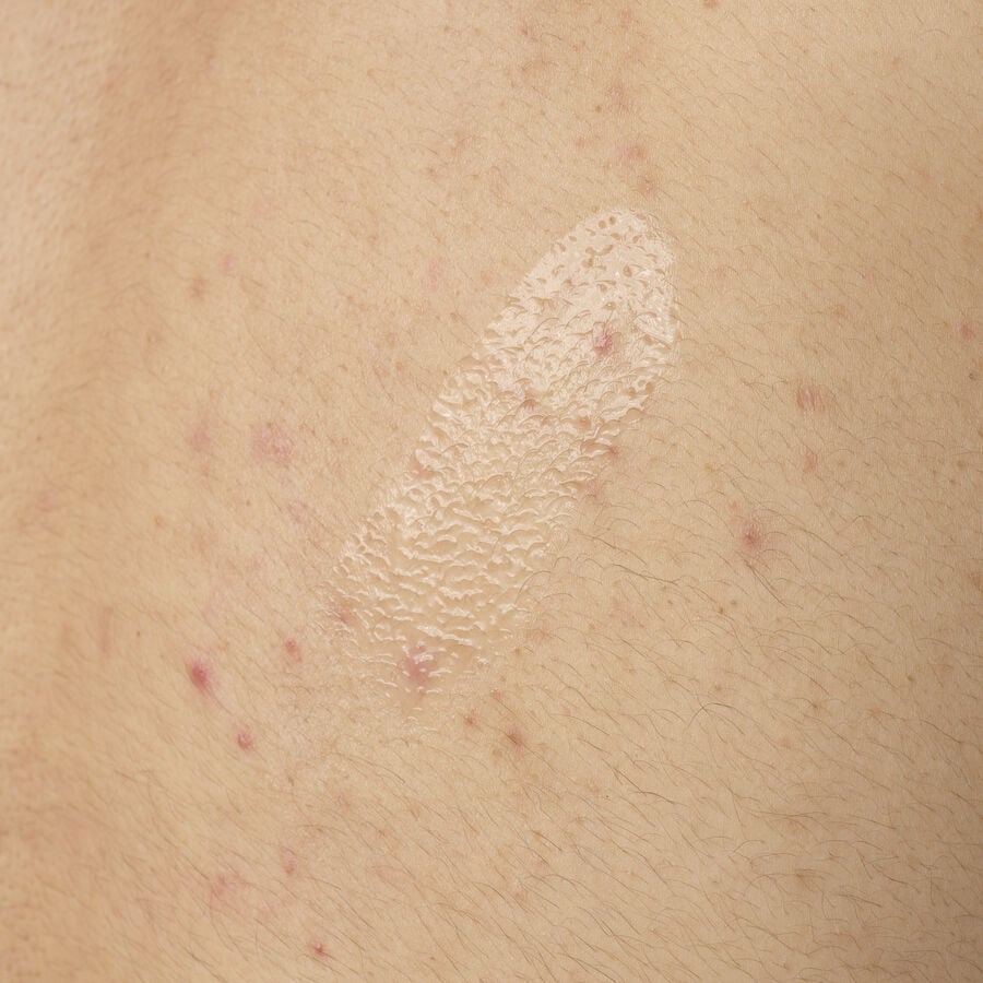 salicylic-acid-0-5-body-serum-h7 ORD-salicylic-acid-05-body-240ml-application.jpg