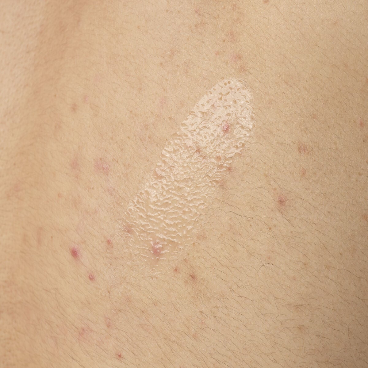 salicylic-acid-0-5-body-serum-h7 ORD-salicylic-acid-05-body-240ml-application.jpg