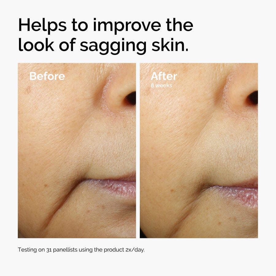 caffeine-3-escin-1-face-serum-n2 ord-caffeine-3pct-escin-1pct-face-serum-before-after-sagging.jpg