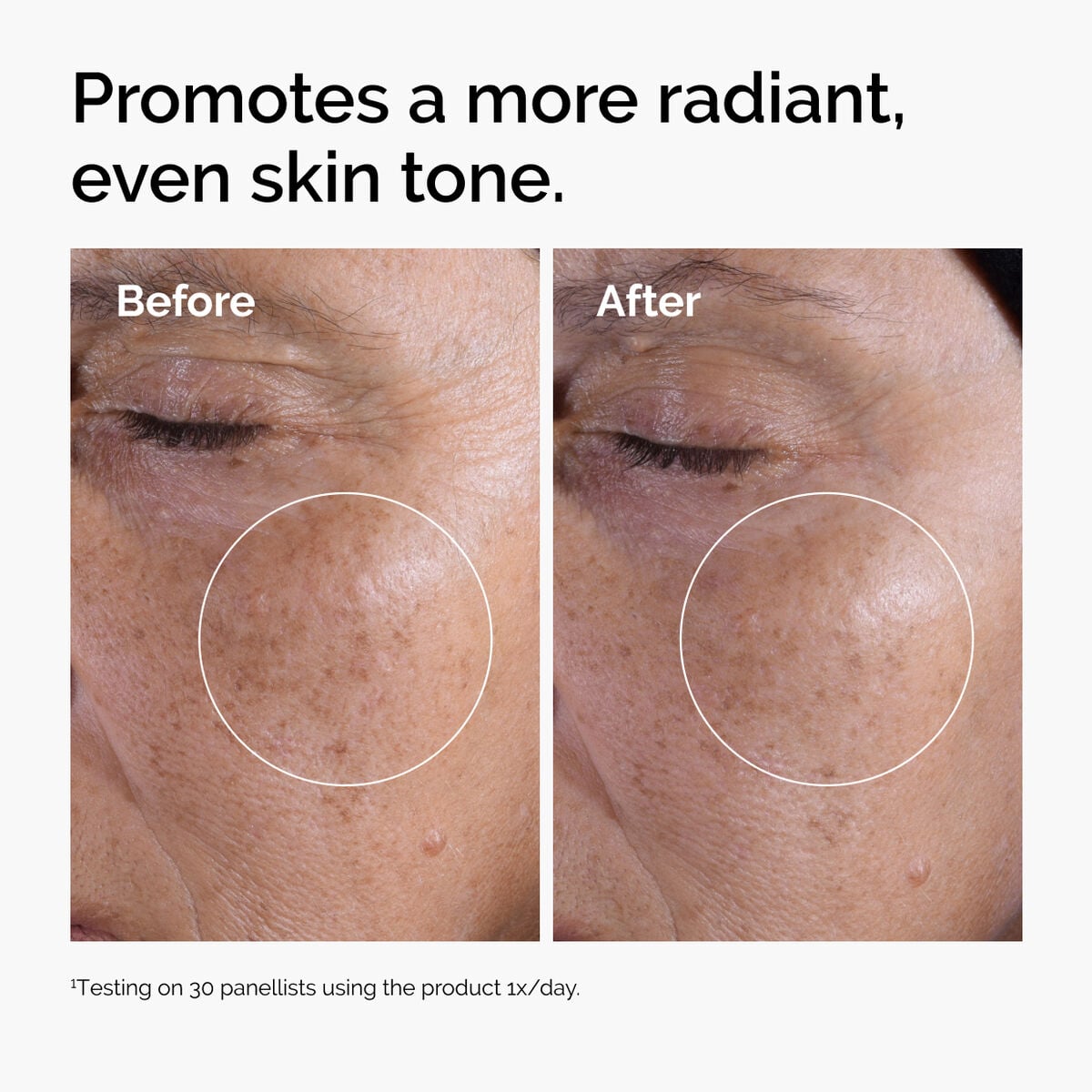 glycolic-acid-7-exfoliating-toner-n1 ord-glycolic-before-after-radiance.jpg