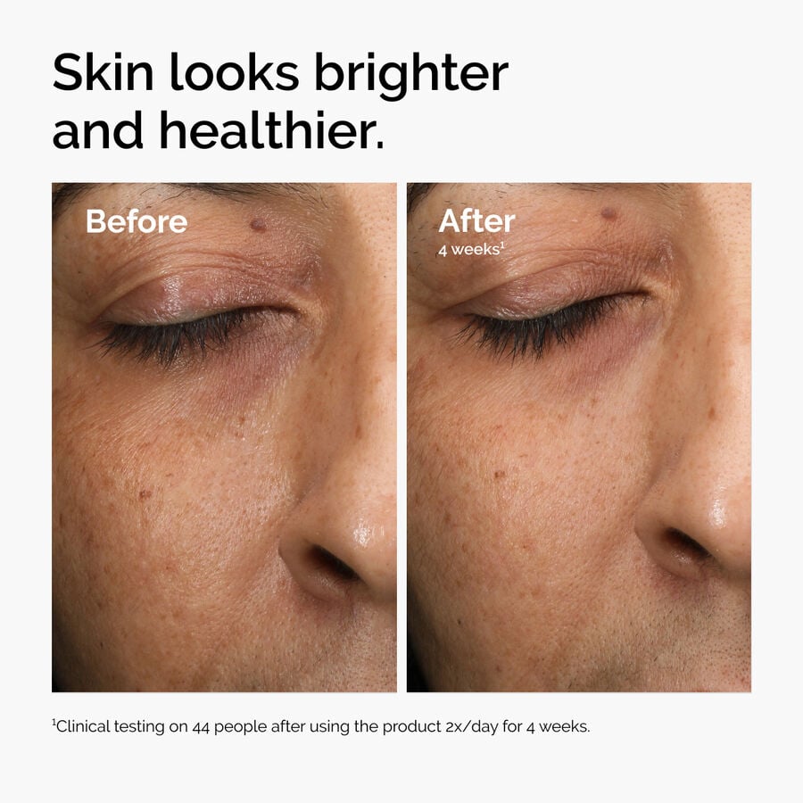 multi-antioxidant-radiance-serum-p5 ord-mars-before-after-healthy.jpg