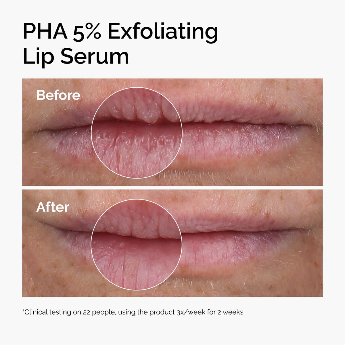 pha-5-exfoliating-lip-serum-g5 ord-pha-5pct-lip-exfoliating-serum-before-after.jpg