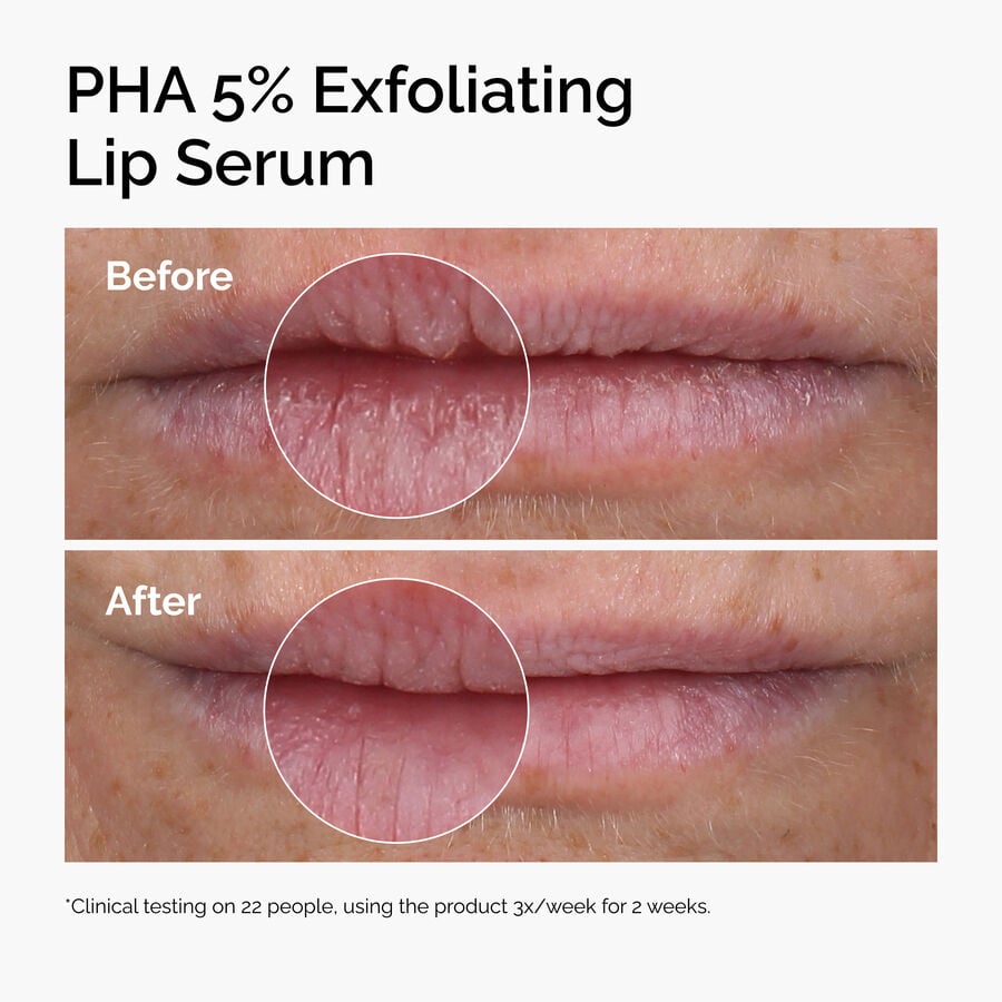 pha-5-exfoliating-lip-serum-g5 ord-pha-5pct-lip-exfoliating-serum-before-after.jpg