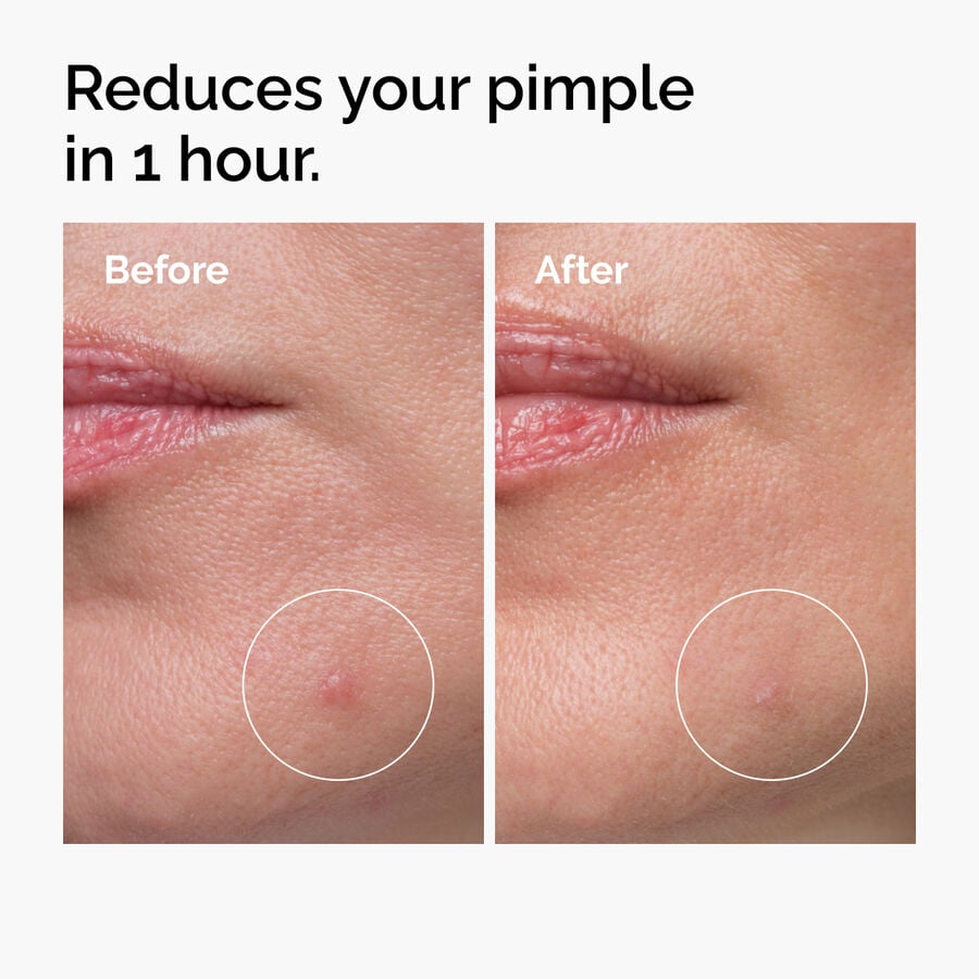 sulfur-10-powder-to-cream-concentrate-n9 ord-sulfur-10pct-powder-to-cream-concentrate-before-after-NA.jpg